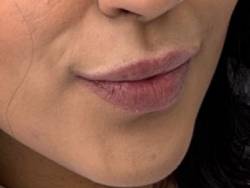10433